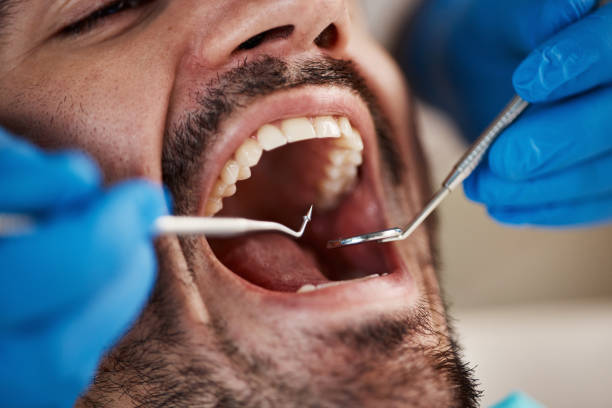 Best Tooth Infection Emergency Dentist  in Redwater, TX